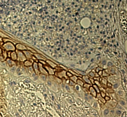 Expression of murine thrombomudulin in keratinocytes during cutaneous would healing